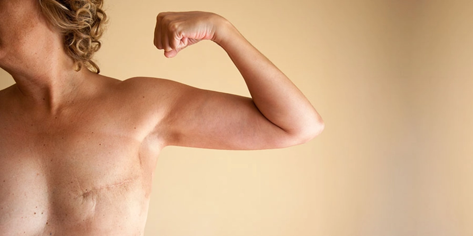 La tiranía del rosa en el cáncer de mama