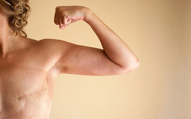 La tiranía del rosa en el cáncer de mama